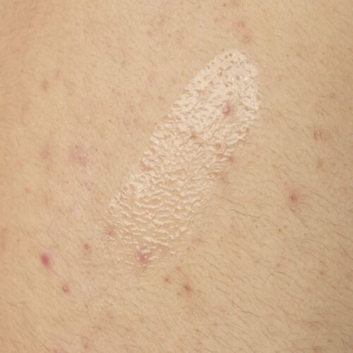 Salicylic Acid 0.5% Body Serum - Image 4